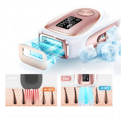 IPL ONTHARINGSAPPARAAT MET ICE-COOLING | PIJNLOOS, SNEL & VEILIG IN HUIS