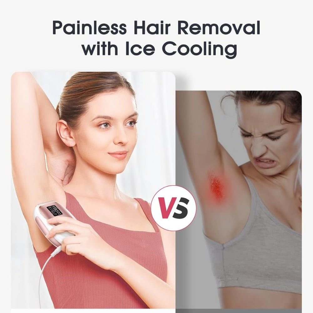 IPL ONTHARINGSAPPARAAT MET ICE-COOLING | PIJNLOOS, SNEL & VEILIG IN HUIS
